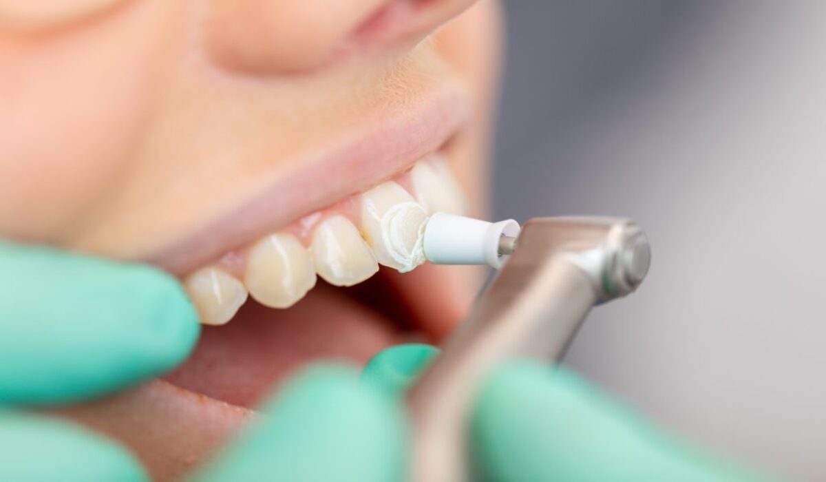 Affordable Cosmetic Dentistry Procedures That Will Transform Your Smile